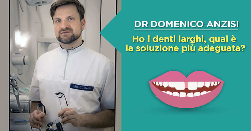 dr-domenico-anzisi-denti-larghi-o-diastema