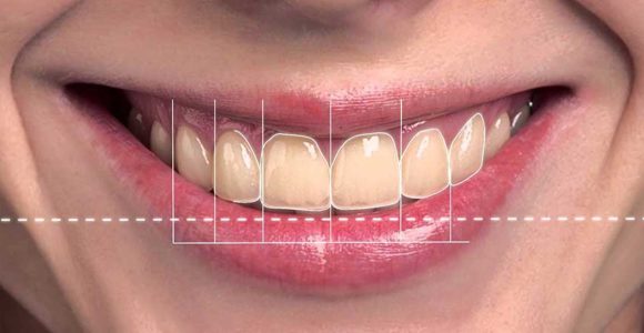 estetica-dentale-simmetria-del-sorriso