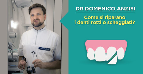 dr-domenico-anzisi-dente-rotto-scheggiato
