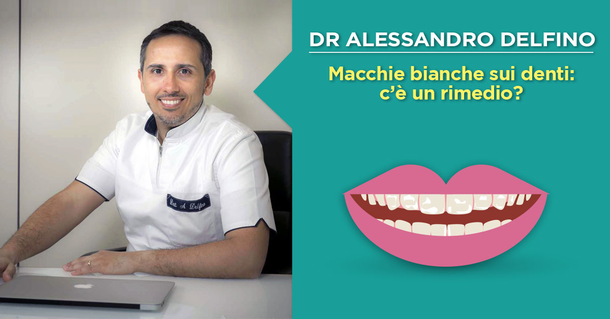 dr-alessandro-delfino-trattamento-macchie-bianche-sui-denti-napoli