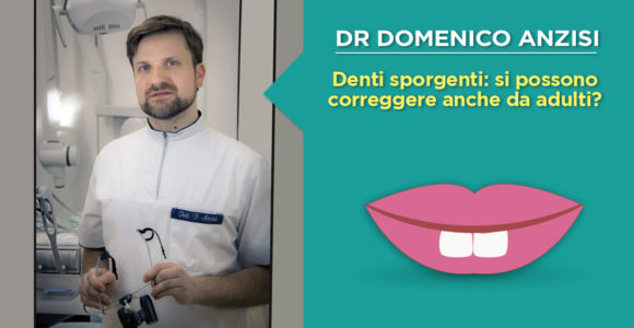 dr-domenico-anzisi-correzione-dei-denti-sporgenti