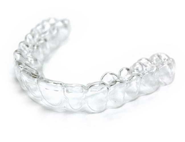 Aligners Invisalign  trasparenti e discreti