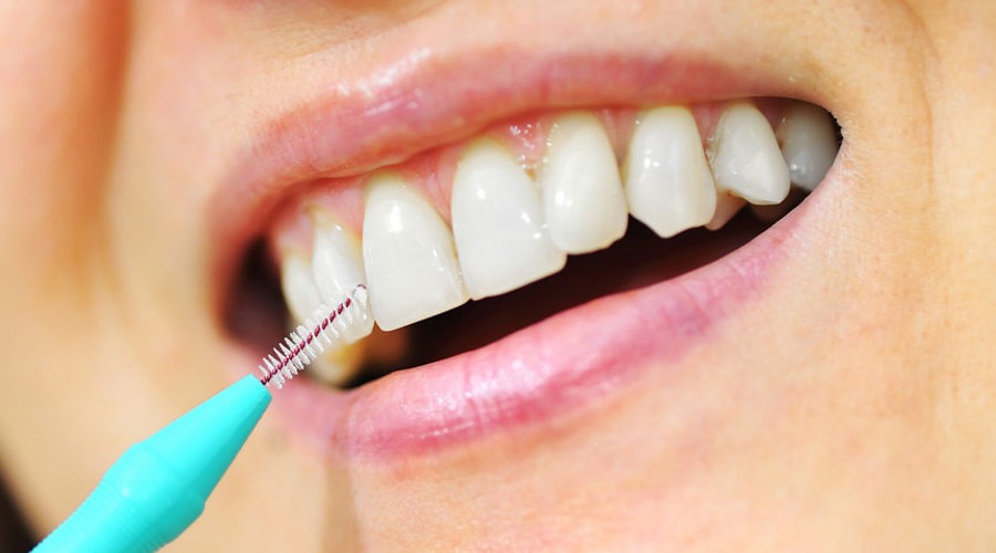 Scovolino dentale: come usarlo e quale scegliere - Studio