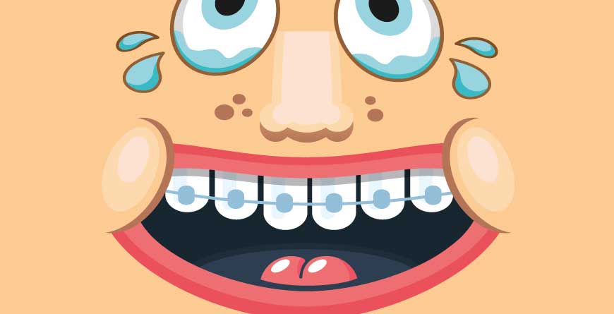 apparecchio-ortodontico-dolore-nei-bambini-delfino-anzisi