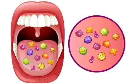 diabete-e-parodontite-il-microbioma-orale