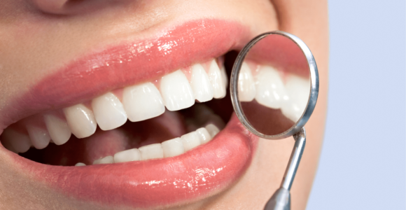 10 elementi per avere denti più forti