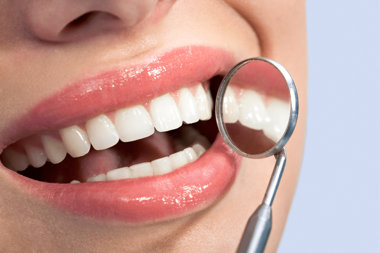 10 elementi per avere denti più forti