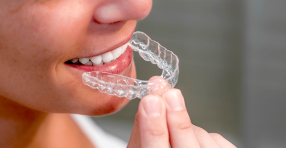 Ortodonzia: come allineare e riposizionare i denti