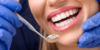 Come scegliere il dentista giusto: 5 consigli utili